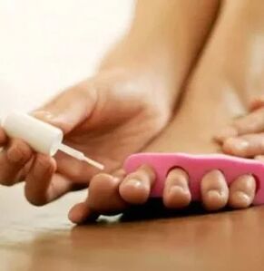 The use of therapeutic varnish